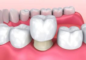 phacomatosis specialists phuket AB Dental Clinic Phuket :Dentist