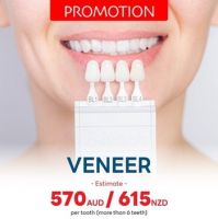 teeth whitening in phuket Sea Smile Dental Clinic